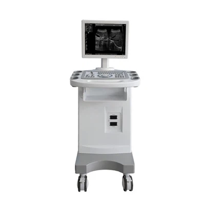 Kocsi B/W ultrahang FTL-UTS80